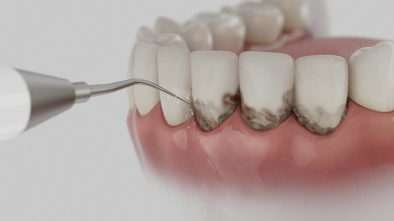 Trusted Root Canal Treatment service in Ledbetter, KY - Dentist Open Now